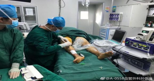 阜阳市二院“蚯蚓腿”治疗有新法